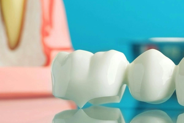 CEREC Same-Day Crown in Lakeview & Alturas