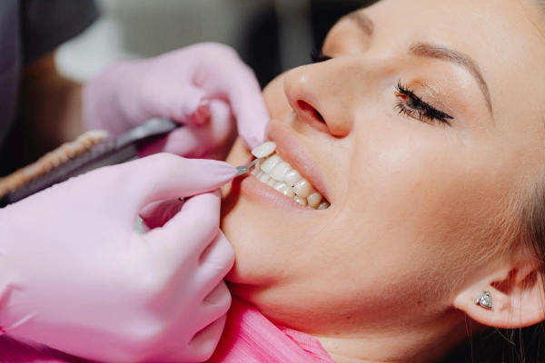 Dental Veneers in Lakeview & Alturas