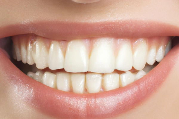 Teeth Whitening in Lakeview & Alturas