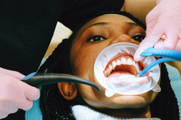 Dental Sealants in Lakeview & Alturas